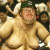 Gynecomastia (férfi mell)